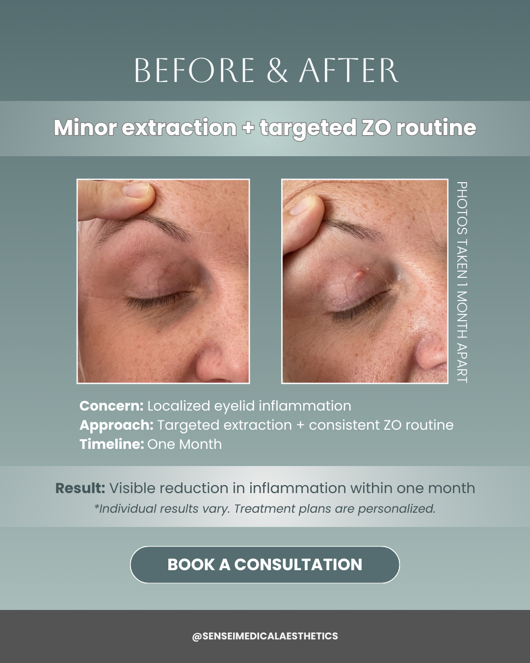Instagram carousel: before and after treatment result with concern, approach and timeline